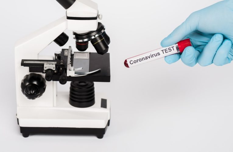 В области зарегистрировано 113 новых случаев заболевания COVID-19