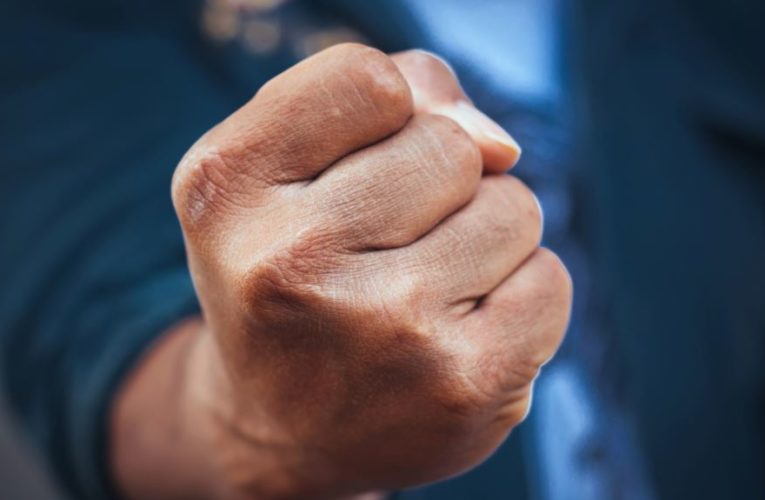 В Каменском конфликт двух мужчин закончился ударом в голову и реанимацией