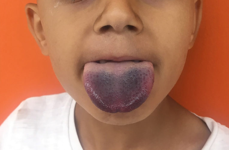 В Днепре врачи спасали ребенка с необычной травмой