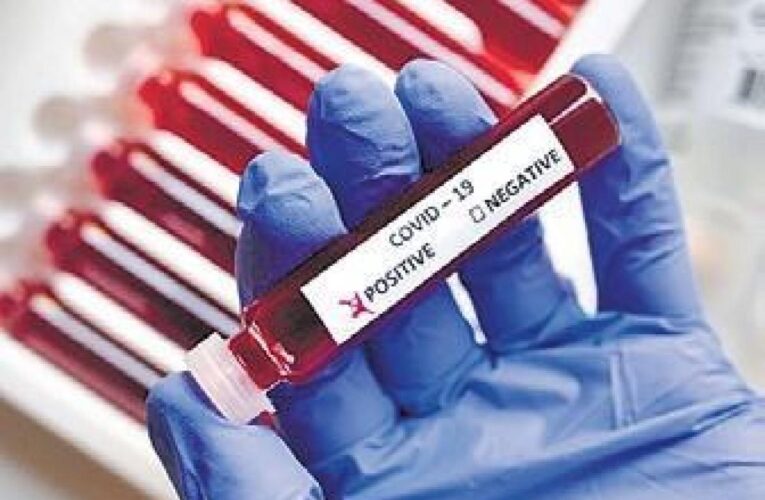 На Днепропетровщине за сутки COVID-19 убил 17 человек и заразил более 200
